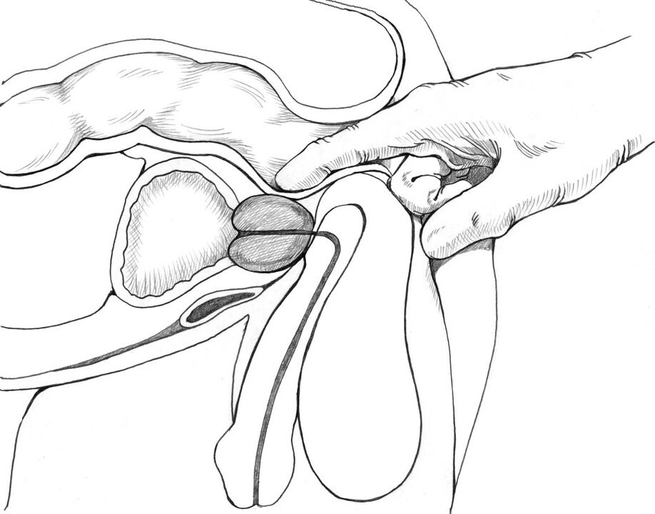 Prostate massage is part of the suite of treatment methods for prostatitis